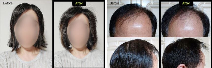 그래비티-샴푸-효과