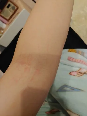 고양이 털 알레르기 완화 방법과 생활 관리 팁_11