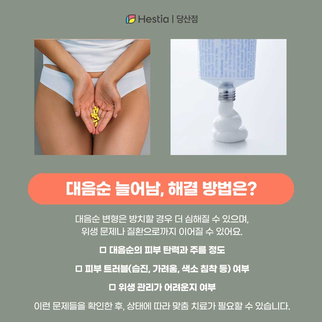 대음순늘어남 해결 방법은?