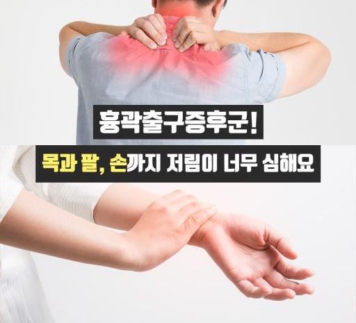 흉곽출구증후군