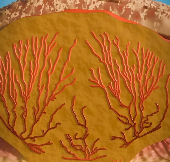 곤지름 초기증상