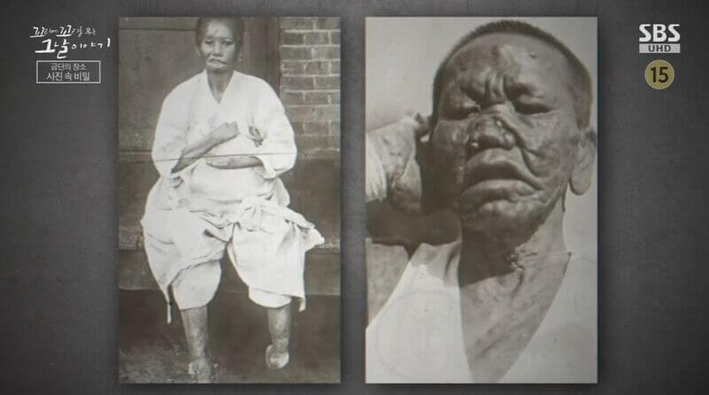 꼬꼬무 ‘소록도’ 편 리뷰: 유리병 태아와 잃어버린 가족의 기록