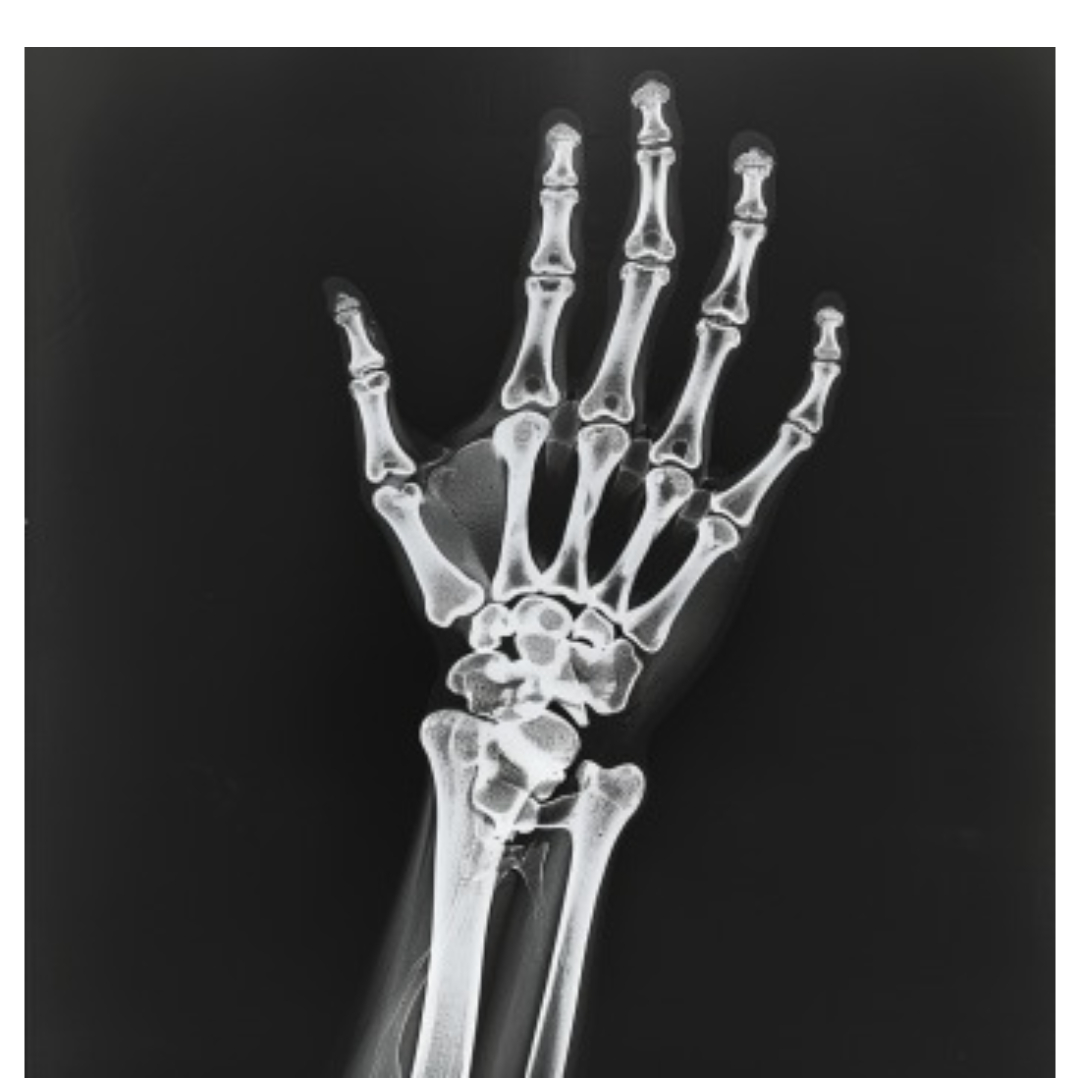 손목통증과 관련된 사진입니다.