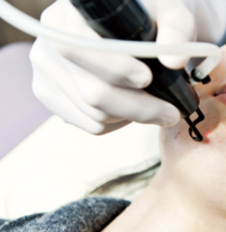 기미·잡티 박살! 피코토닝 효과 설명 사진