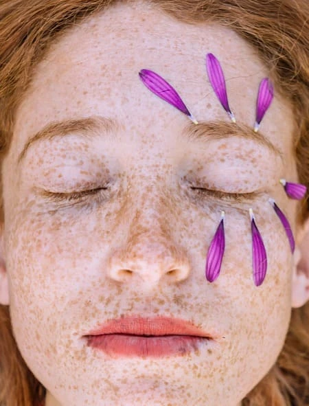 트라넥삼산 효능