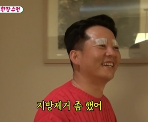 김준호 안검하수