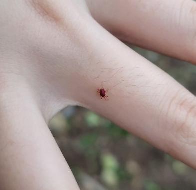 빨간 진드기 다카라다니 물림 아이 강아지 고양이 물리면 치료 예방 퇴치 방법
