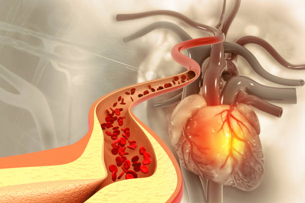 고지혈증 약의 부작용에 대해 알아보자
