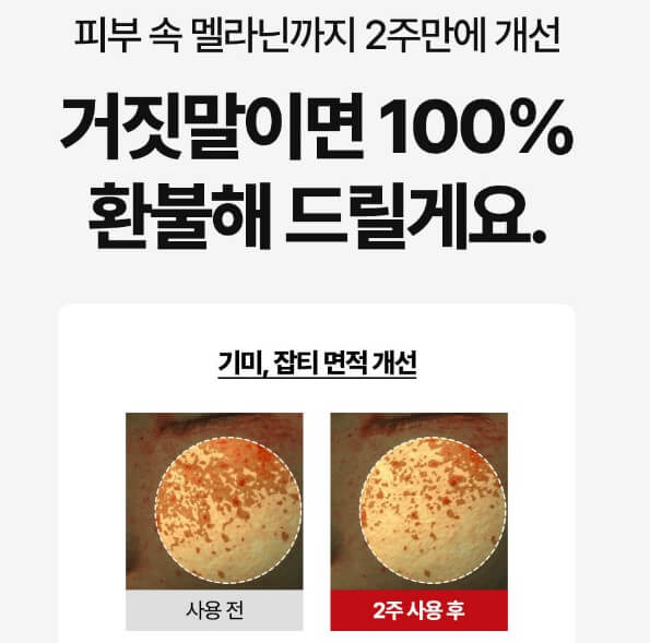 피부속 멜라닌
