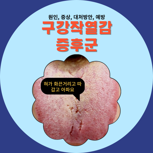 구함증, 구고증, 구강건조증, 구강작열감증후군: 이들의 원인과 증상을 파헤쳐보자