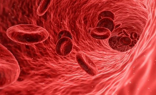고혈압 낮추는 방법 고혈압증상