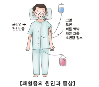 폐혈증이란? 원인 주요증상 치료법 정리