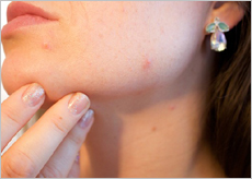 라벤다 크림 효능&amp;#44; 가격&amp;#44; 부작용&amp;#44; 무좀&amp;#44; 질염&amp;#44; 여드름