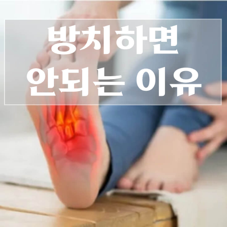 당뇨발-초기증상