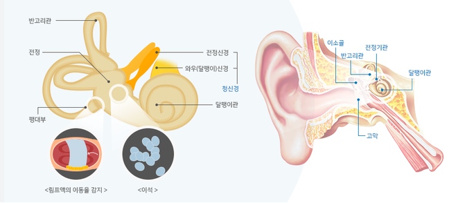 이석증 원인