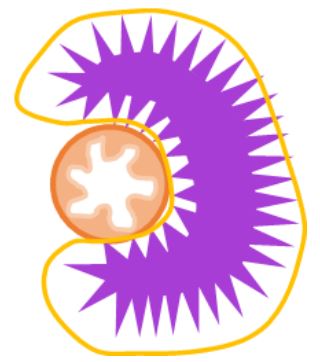 IMRT 방사선