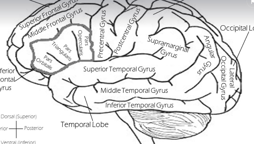 뇌의 모습(뇌졸중 VS 뇌경색)