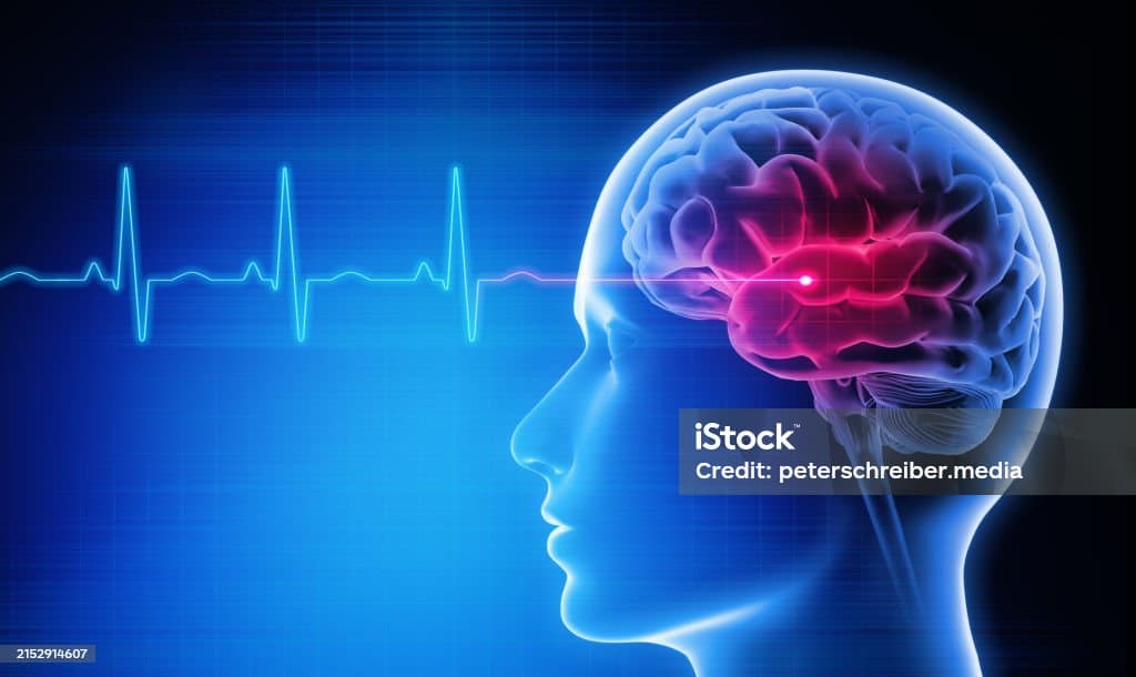 스마트폰 과다 사용이 뇌 건강에 미치는 영향