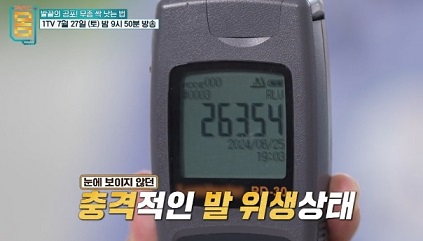 충격적인발위생상태