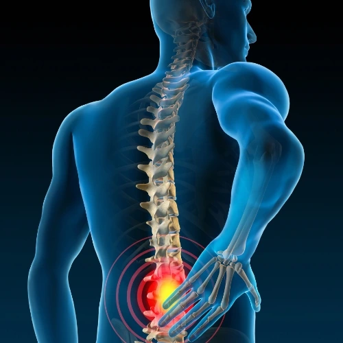 허리디스크통증