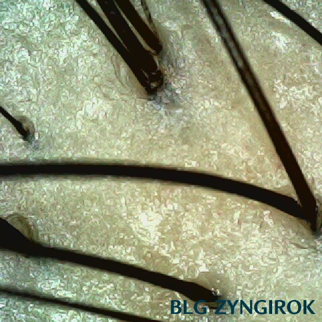 정수리 두피 사진이다.