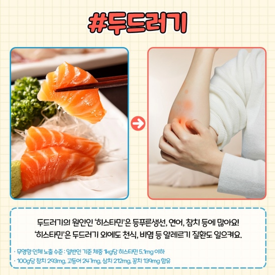 아플때 피해야하는 수산물, 두드러기