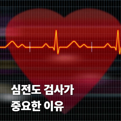 1. 심전도 검사가 중요한 이유