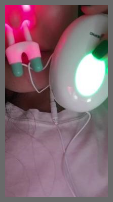 코에픽 부작용 효과