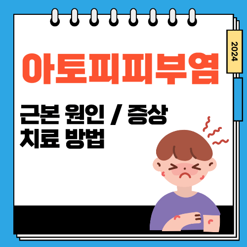 아토피피부염의 근본 원인과 효과적인 치료 방법