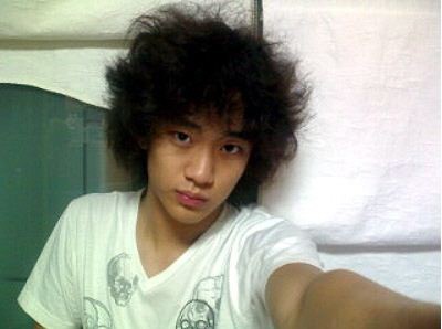 모발이식 3000모 비용