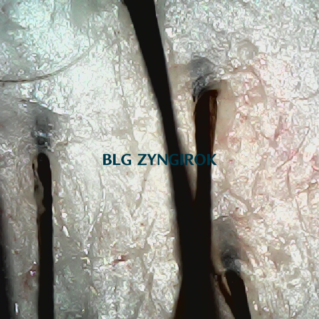 탈모 극복 프로젝트 - 뒷머리 두피 모습이다.