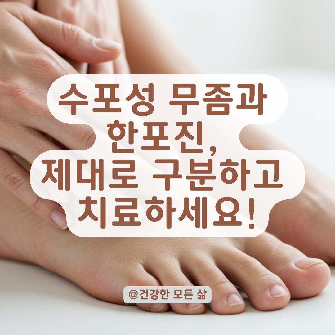수포성 무좀 vs 한포진, 비슷하지만 다른 증상과 구별 포인트 총정리.