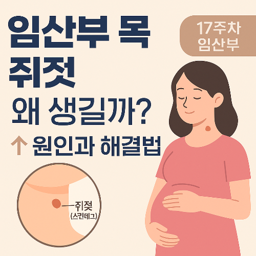 임산부 목 쥐젖 왜생길까? 원인과 해결법