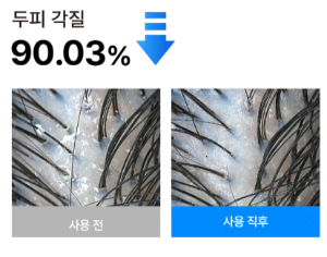 탈모앰플 닥터33