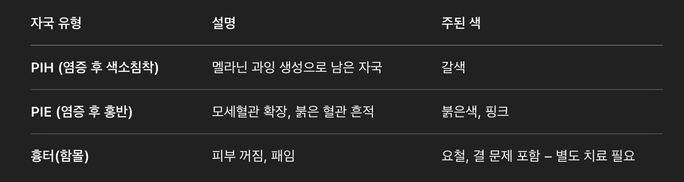 자국의 종류를 먼저 파악하자