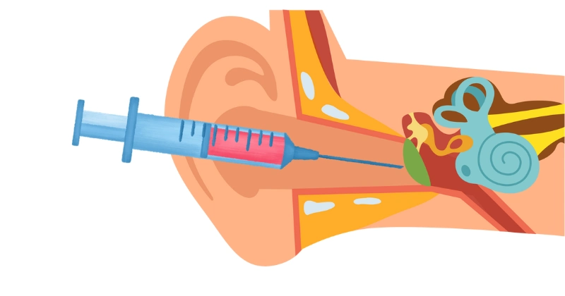 스테로이드 치료