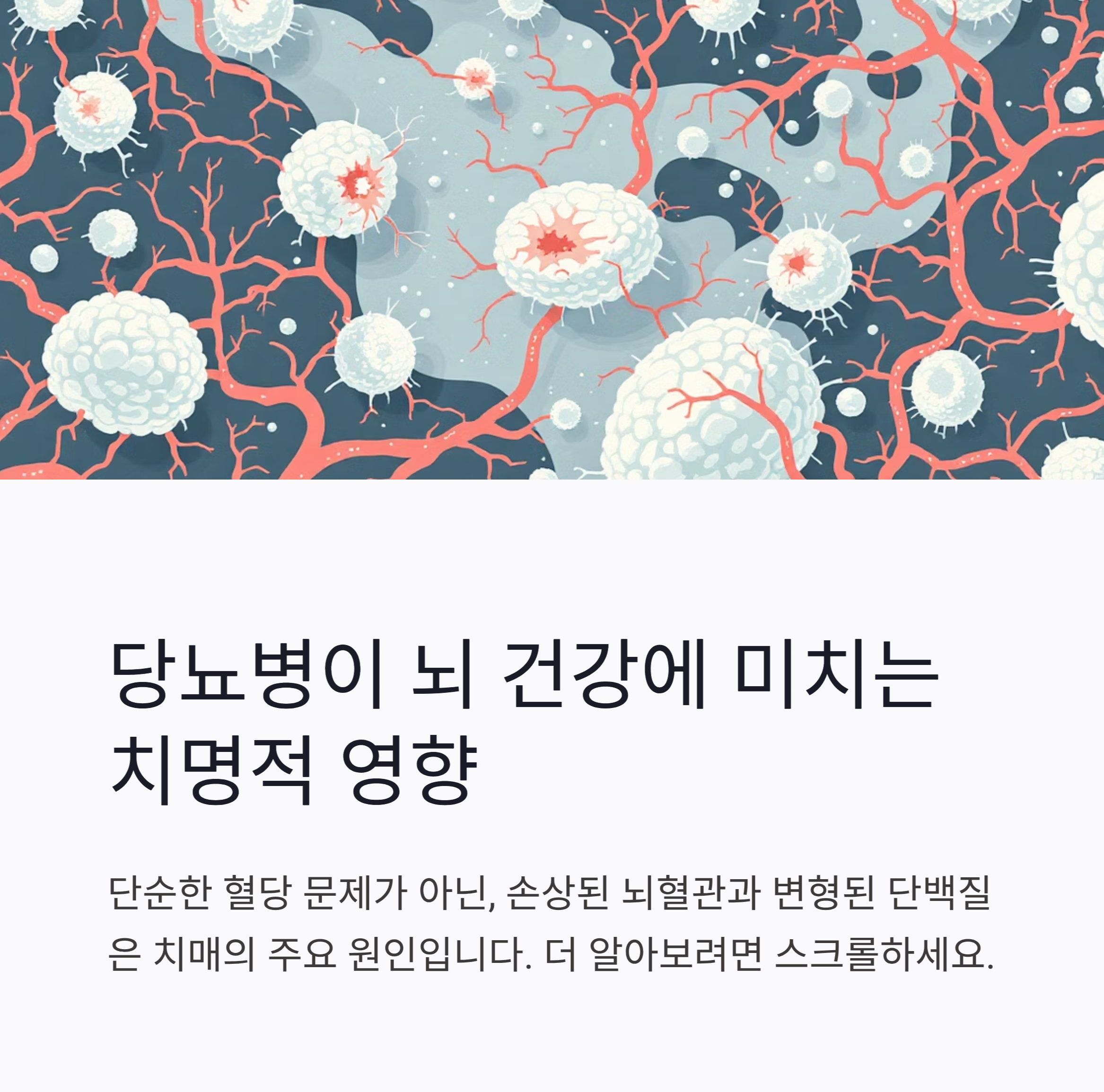 (당뇨병성 치매)