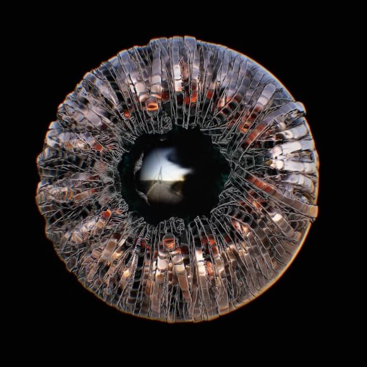 유리체 출혈된 모습