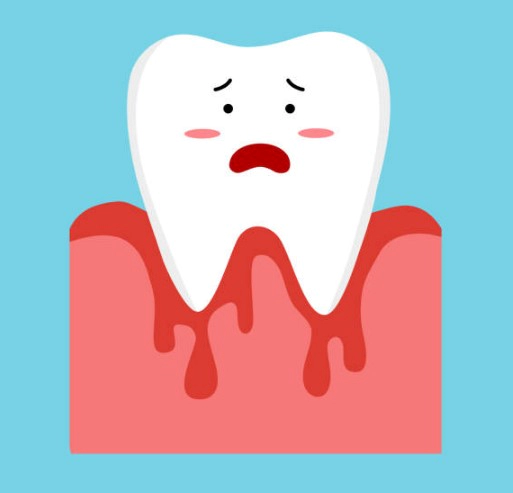 치은염 치료방법 영양제 추천