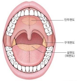 편도선염 증상