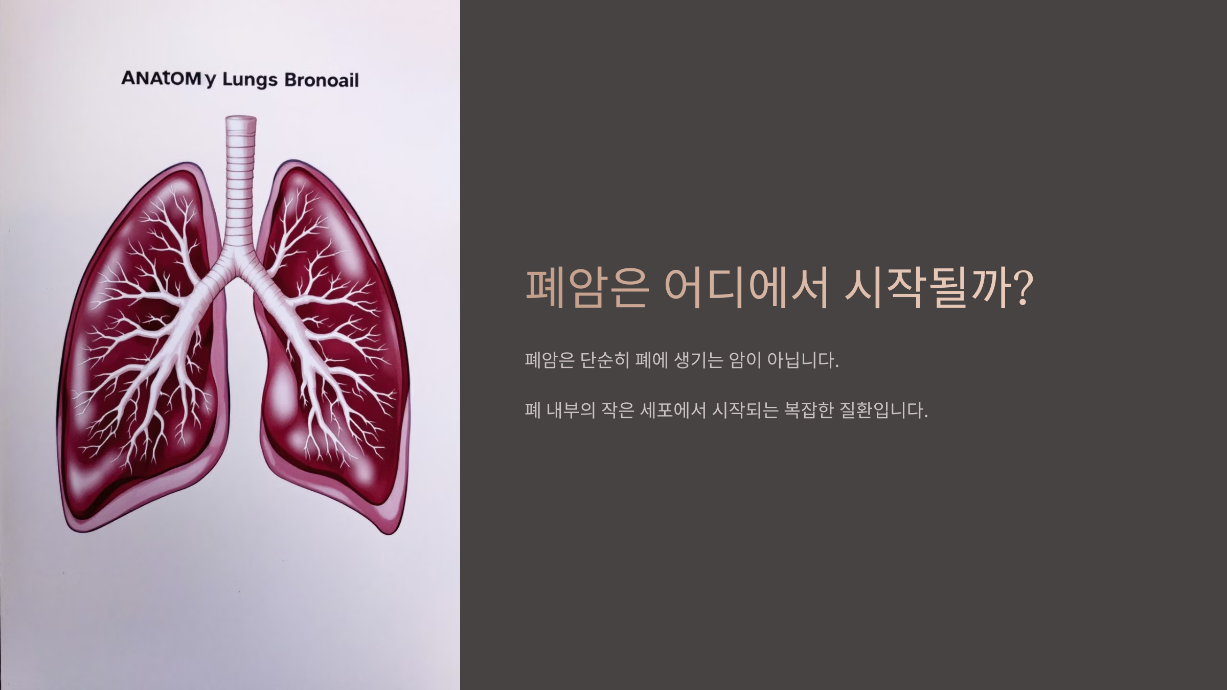 폐암은 어디에서 시작될까?