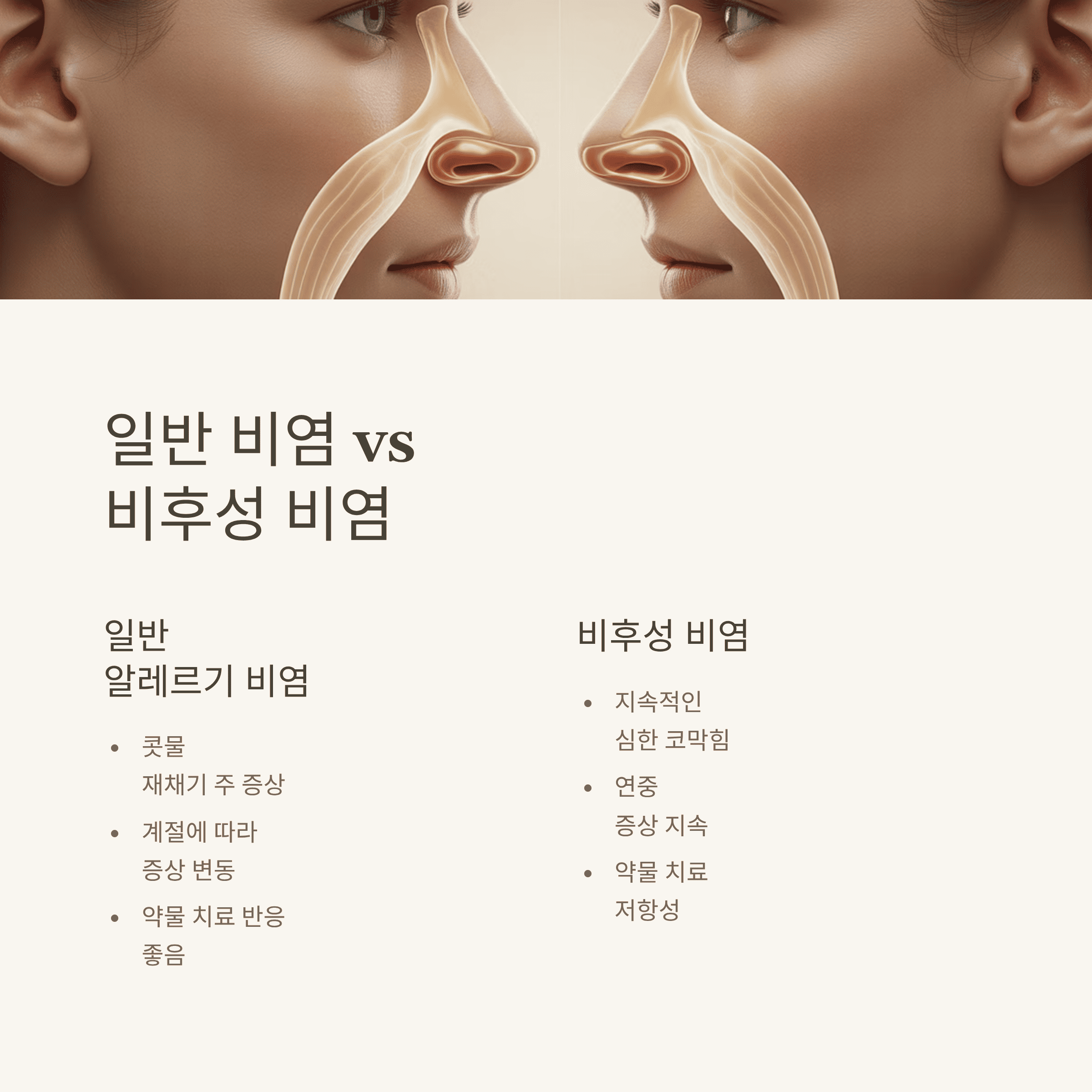 비후성 비염 증상과 효과적인 치료법 완벽 분석
