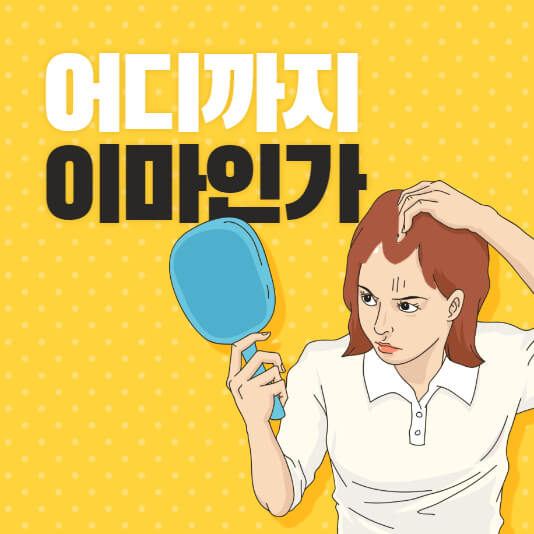 여자-탈모