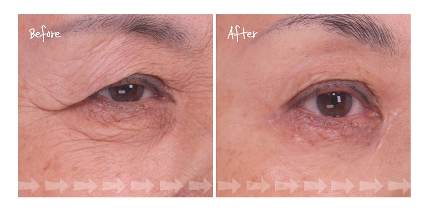 주름다나와-크림-솔직후기-2