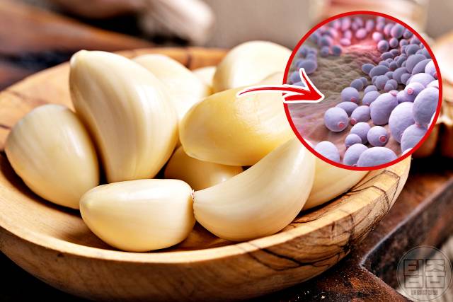 질염 자연치료 마늘