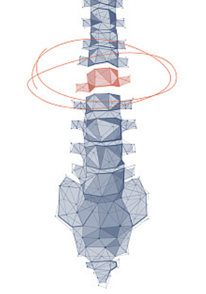 발바닥통증의 원인 36