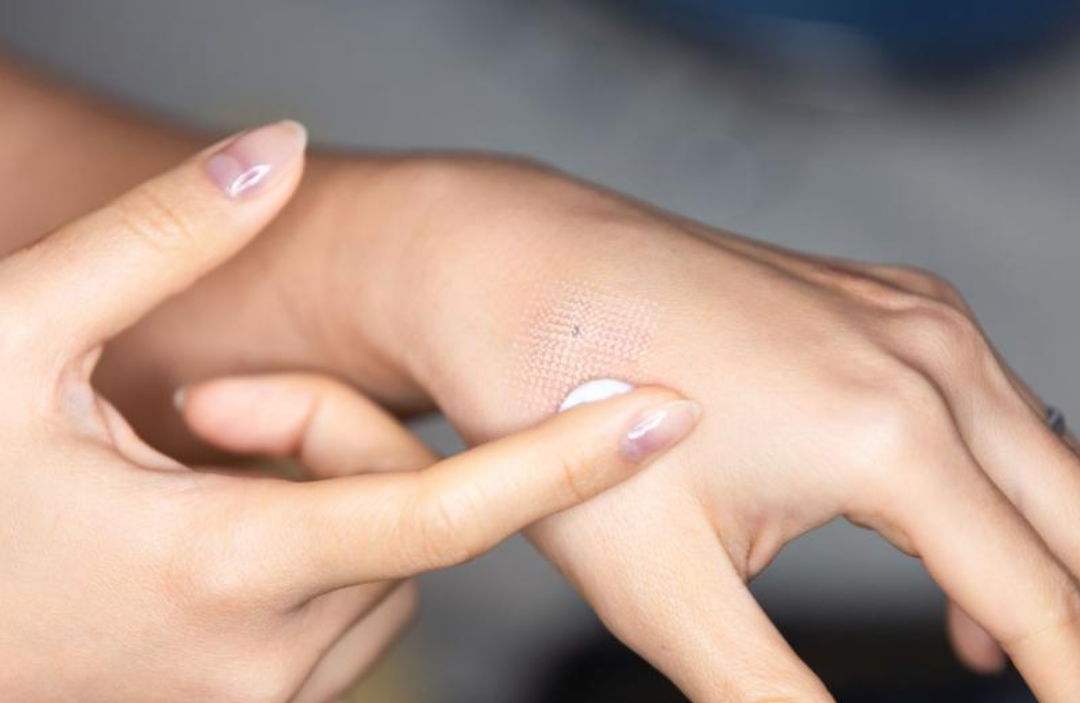 한 여성이 손등에 크림을 바르고 있다.