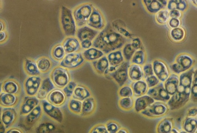 비임균성 요도염의 발병 원인