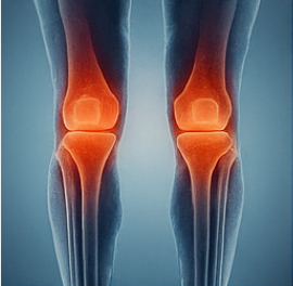 콘드로이친1200mg