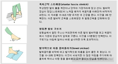 족저근막염 치료-스트레칭
